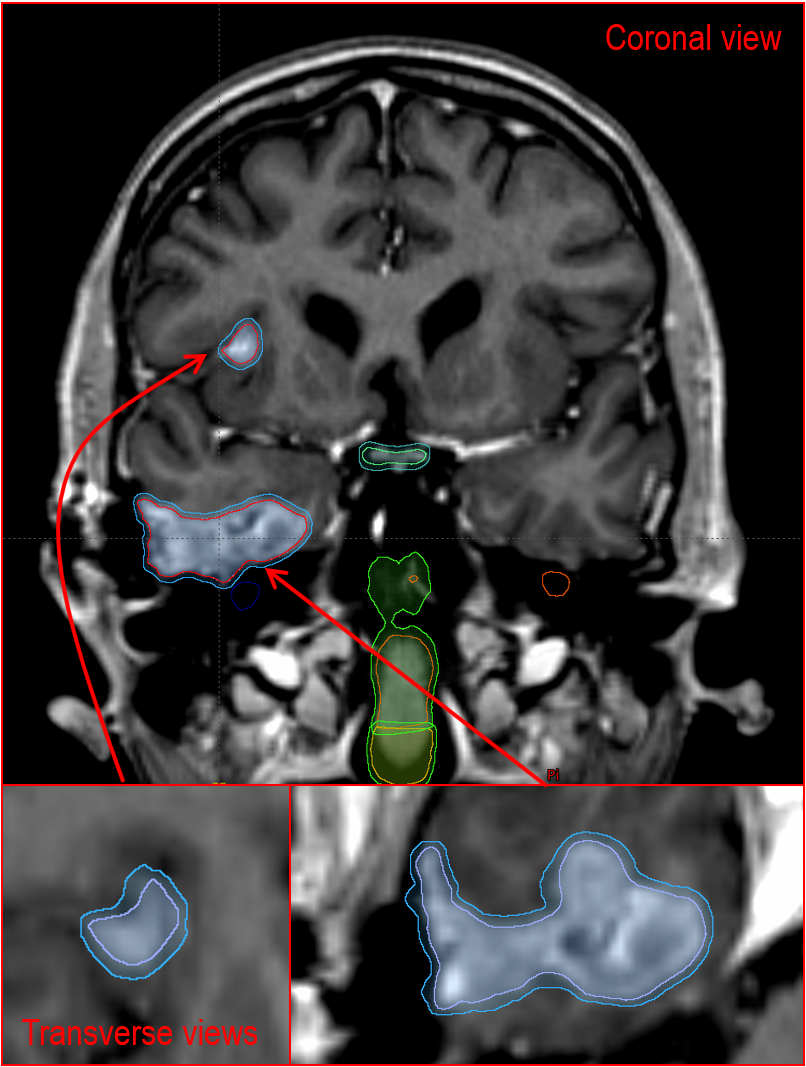 image_transcoder.php?o=sys_images_editor&h=30&dpx=1&t=1701884411