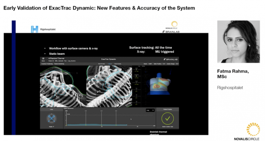 Exactrac Early Validation of ExacTrac Dynamic: New Features and Accuracy of the ...