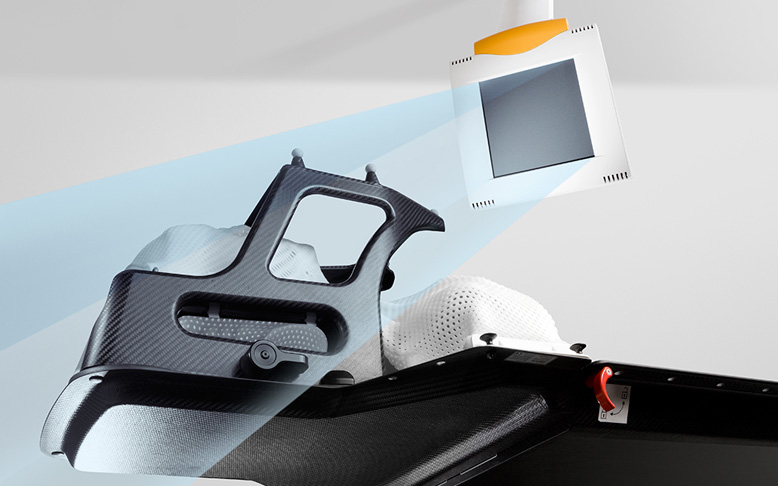 Margin of Error for a Frameless Image Guided Radiosurgery System: Direct Confirmation Based on Posttreatment MRI Scans
